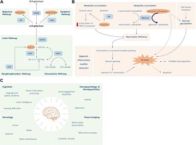 Brain function in classic galactosemia, a galactosemia network (GalNet) members review